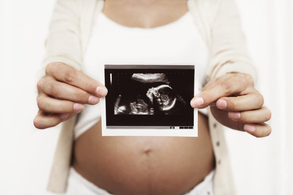 Surrogatmamma i Georgien - Nordic Surrogacy